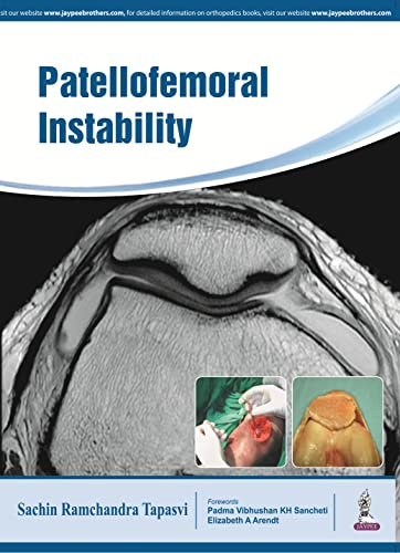 technical/general/patellofemoral-instability-1-ed-9789385999666