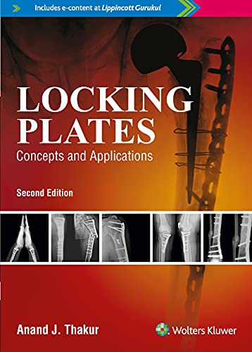 medical/orthopaedics/locking-plates-concepts-and-applications-9789387963764