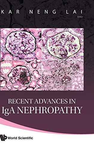 medical/nephrology/recent-advances-in-iga-nephropathy-9789812835864