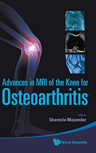 medical/orthopaedics/adv-in-mri-of-the-knee-for-osteoarthriti-9789814271707