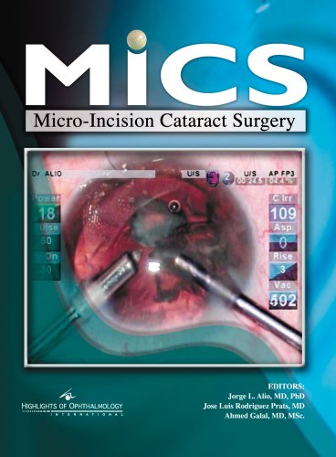 medical/ophthalmology/mics-micro-incision-cataract-surgery-9789962613305